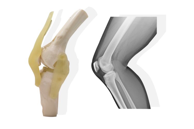 Applications of Plastic Injection Molding in the Medical Device Industry