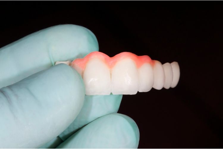 Dental Materials