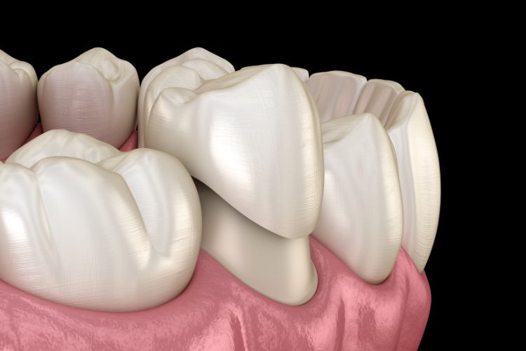 Zirconia